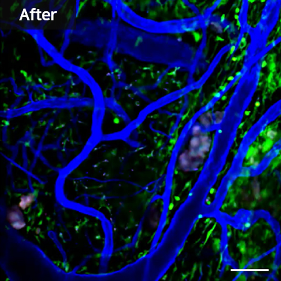 The AI-Driven Solution